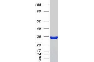 Western Blotting (WB) image for phosphoribosyl Pyrophosphate Synthetase 1 (PRPS1) protein (Myc-DYKDDDDK Tag) (ABIN2729834)