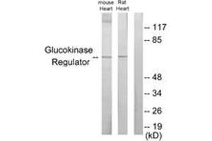 Western Blotting (WB) image for anti-Glucokinase (Hexokinase 4) Regulator (GCKR) (AA 211-260) antibody (ABIN2889589) (GCKR Antikörper  (AA 211-260))