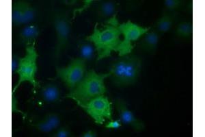Anti-CORO1B mouse monoclonal antibody (ABIN2452912) immunofluorescent staining of COS7 cells transiently transfected by pCMV6-ENTRY CORO1B (RC203023). (CORO1B Antikörper)