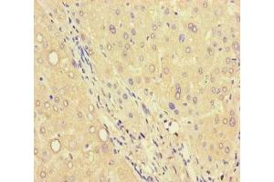 Immunohistochemistry of paraffin-embedded human liver tissue using ABIN7174872 at dilution of 1:100 (C6orf223 Antikörper  (AA 9-89))