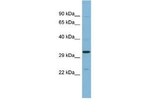 WB Suggested Anti-SET Antibody Titration: 0. (SET/TAF-I Antikörper  (N-Term))