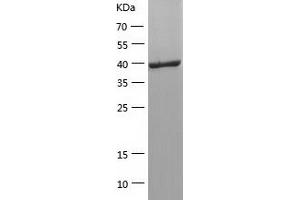 Western Blotting (WB) image for Selenoprotein P (SEPP1) (AA 20-381) protein (His tag) (ABIN7125017)