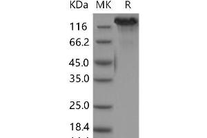 Western Blotting (WB) image for DEAD/H (Asp-Glu-Ala-Asp/His) Box Polypeptide 11 (DDX11) protein (His tag) (ABIN7320027) (DDX11 Protein (His tag))