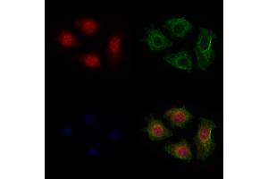 ABIN6265048 and ABIN6279809 staining HepG2 cells by IF/ICC. (SH2B3 Antikörper  (N-Term))