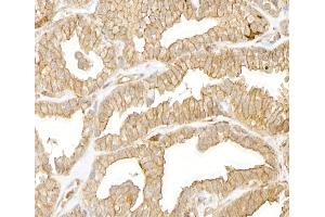 anti-Cytoskeletal Actin (CIMG_00972) (N-Term) antibody