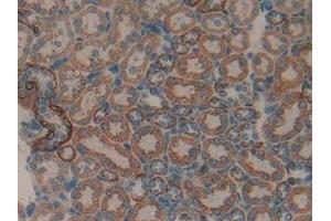 Detection of MMP9 in Rat Kidney Tissue using Polyclonal Antibody to Matrix Metalloproteinase 9 (MMP9)