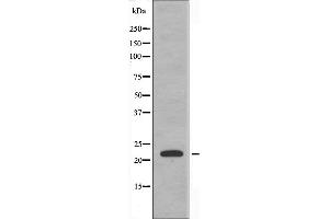 Western blot analysis of extracts from LOVO cells, using TUSC5 antibody. (TUSC5 Antikörper  (N-Term))