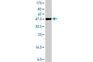 Western Blot detection against Immunogen (37 KDa) . (Formin 2 Antikörper  (AA 144-243))