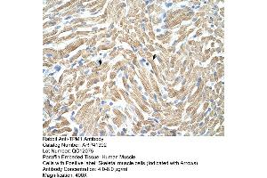 Rabbit Anti-TPM1 Antibody  Paraffin Embedded Tissue: Human Muscle Cellular Data: Skeletal muscle cells Antibody Concentration: 4. (Tropomyosin Antikörper  (N-Term))