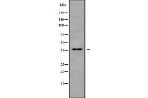 Western blot analysis of MARCH9 using MCF7 whole cell lysates (MARCH9 Antikörper  (N-Term))