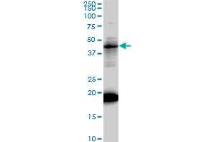 LEF1 monoclonal antibody (M01), clone 3H5. (LEF1 Antikörper  (AA 1-399))