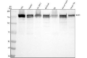 Western blot analysis of SOS1 using anti-SOS1 antibody (ABIN7606353).