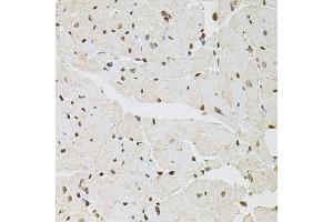 Immunohistochemistry of paraffin-embedded mouse heart using FOSL1 antibody (ABIN5973108) at dilution of 1/100 (40x lens). (FOSL1 Antikörper)