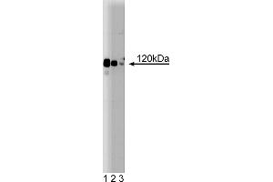 Western Blotting (WB) image for anti-Protein Kinase N1 (PKN1) (AA 215-388) antibody (ABIN968110) (PKN1 Antikörper  (AA 215-388))