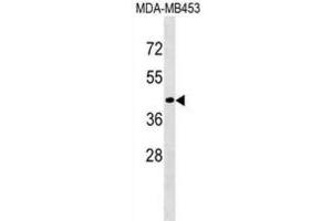 Western Blotting (WB) image for anti-CD200 Receptor 1-Like (CD200R1L) antibody (ABIN3000748)