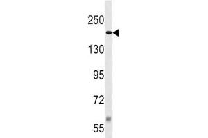 Western Blotting (WB) image for anti-Tuberous Sclerosis 2 (TSC2) (AA 1364-1393) antibody (ABIN3029314)