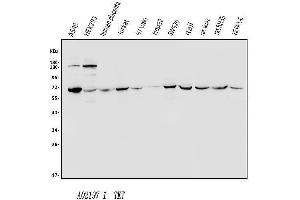 Western blot analysis of Transketolase/TKT using anti-Transketolase/TKT antibody (ABIN7598959).