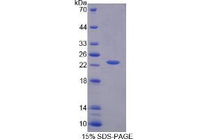 Image no. 1 for Indoleamine 2,3-Dioxygenase (IDO) (AA 26-199) protein (His tag) (ABIN6236759) (IDO Protein (AA 26-199) (His tag))