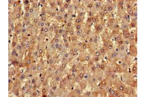 Immunohistochemistry of paraffin-embedded human liver tissue using ABIN7161655 at dilution of 1:100 (NLRX1 Antikörper  (AA 45-205))