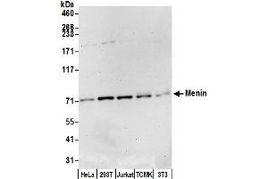 Western Blotting (WB) image for anti-Multiple Endocrine Neoplasia 1 (MEN1) (C-Term) antibody (ABIN7452196)