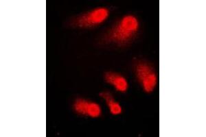 Immunofluorescent analysis of CBP staining in A431 cells. (CBP Antikörper  (C-Term))