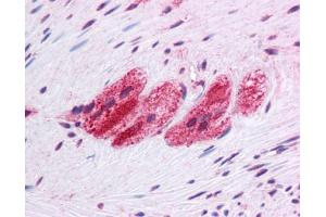 Immunohistochemistry (IHC) image for anti-Selenoprotein N, 1 (SEPN1) (C-Term) antibody (ABIN617009) (SEPN1 Antikörper  (C-Term))