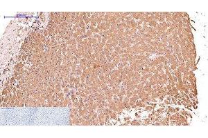 Immunohistochemistry of paraffin-embedded Human liver tissue using CK-17 Monoclonal Antibody at dilution of 1:200. (KRT17 Antikörper)