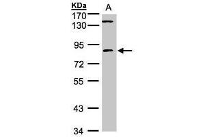WB Image Sample (30μg whole cell lysate) A:293T 7. (LIMK2 Antikörper)