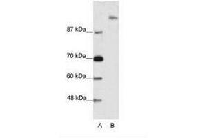 Image no. 1 for anti-Suppressor of Ty 6 Homolog (SUPT6H) (N-Term) antibody (ABIN202988) (Spt6 Antikörper  (N-Term))