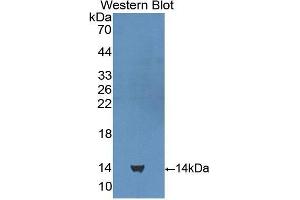Western Blotting (WB) image for anti-Cubilin (Intrinsic Factor-Cobalamin Receptor) (CUBN) (AA 3511-3623) antibody (ABIN1858561)