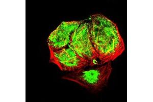 Immunofluorescence (IF) image for anti-Ankyrin Repeat-Containing Protein (EHMT2) (AA 317-471) antibody (ABIN7193340)
