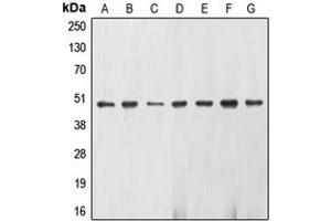 Western blot analysis of Gamma-enolase expression in U937 (A), K562 (B), Jurkat (C), NIH3T3 (D), KNRK (E), HepG2 (F), HeLa (G) whole cell lysates. (ENO2/NSE Antikörper  (C-Term))