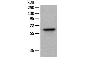 Western blot analysis of Hela cell lysate using BAIAP2L1 Polyclonal Antibody at dilution of 1:1000 (BAIAP2L1 Antikörper)