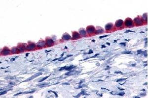 Immunohistochemical staining of Ovary (Epithelium) using anti- GPR133 antibody ABIN122481 (G Protein-Coupled Receptor 133 Antikörper)