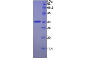 SDS-PAGE analysis of Human FKBP10 Protein. (FKBP10 Protein)