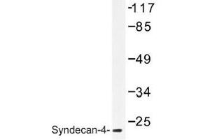 Image no. 1 for anti-Syndecan 4 (SDC4) antibody (ABIN317791) (SDC4 Antikörper)