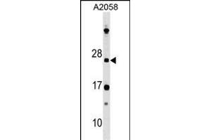 DR Antibody (N-term) 8211a western blot analysis in  cell line lysates (35 μg/lane). (DRAP1 Antikörper  (N-Term))