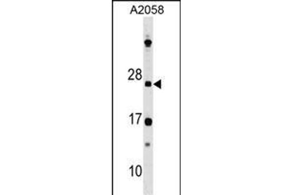 DRAP1 anticorps  (N-Term)