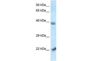 WB Suggested Anti-Vps72 Antibody   Titration: 1. (VPS72 Antikörper  (N-Term))