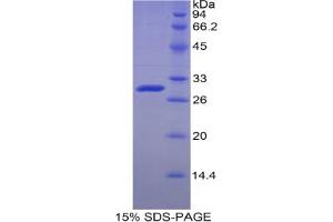SDS-PAGE analysis of Human Adenosine Kinase Protein. (ADK Protein)