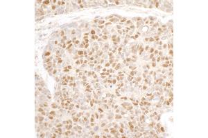 Immunohistochemistry (IHC) image for anti-Minichromosome Maintenance Complex Component 3 (MCM3) (AA 500-550) antibody (ABIN7453566)