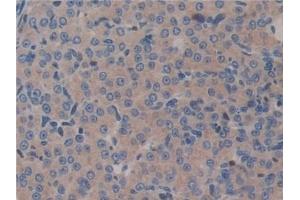 Detection of GAB3 in Mouse Ovary Tissue using Polyclonal Antibody to GRB2 Associated Binding Protein 3 (GAB3) (GAB3 Antikörper  (AA 142-375))