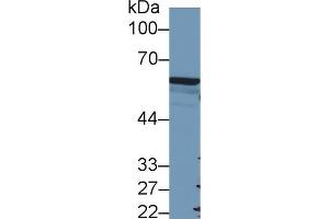 Western blot analysis of Human A549 cell lysate, using Mouse FOXP3 Antibody (2 µg/ml) and HRP-conjugated Goat Anti-Rabbit antibody ( (FOXP3 Antikörper  (AA 190-412))