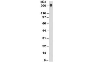 Western blot testing of Jurkat cell lysate with TAG-72 antibody (clone CC49). (TAG-72 Antikörper)