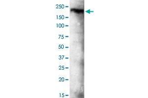 Western blot analysis of KDM3B monoclonal antibody  at 1 : 500 dilution. (KDM3B Antikörper  (C-Term))