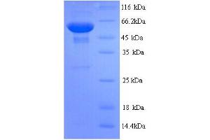 SDS-PAGE (SDS) image for Spermine Oxidase (SMOX) (AA 1-555), (full length) protein (His tag) (ABIN5713848)