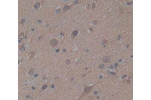 IHC-P analysis of Human Tissue, with DAB staining. (BIRC6 Antikörper  (AA 4576-4857))