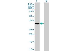 Western Blot analysis of ANXA3 expression in transfected 293T cell line by ANXA3 MaxPab polyclonal antibody. (Annexin A3 Antikörper  (AA 1-323))