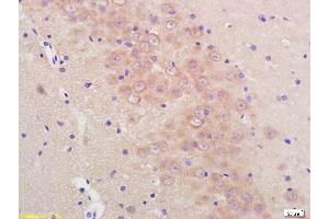 Formalin-fixed and paraffin embedded rat brain labeled with Anti-Phospho-Mcl1 (Ser159/Thr163) Polyclonal Antibody, Unconjugated (ABIN743738) at 1:200, followed by conjugation to the secondary antibody and DAB staining (MCL-1 Antikörper  (pSer159, pThr163))