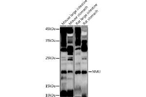 Western blot analysis of extracts of various cell lines, using NMU antibody (ABIN6128376, ABIN6144691, ABIN6144692 and ABIN6222862) at 1:1000 dilution. (Neuromedin U Antikörper  (AA 35-174))